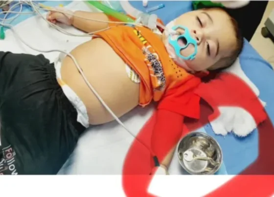 医生从 5 岁儿童胃中取出钥匙